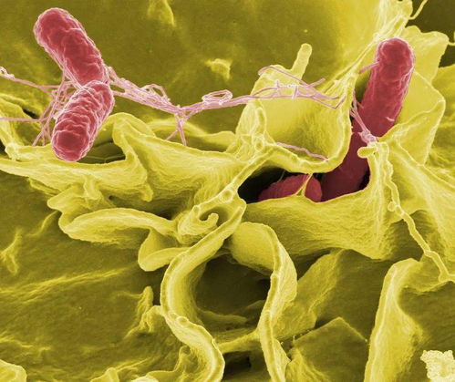 粪便微生物 给免疫检查点抑制剂 添把火